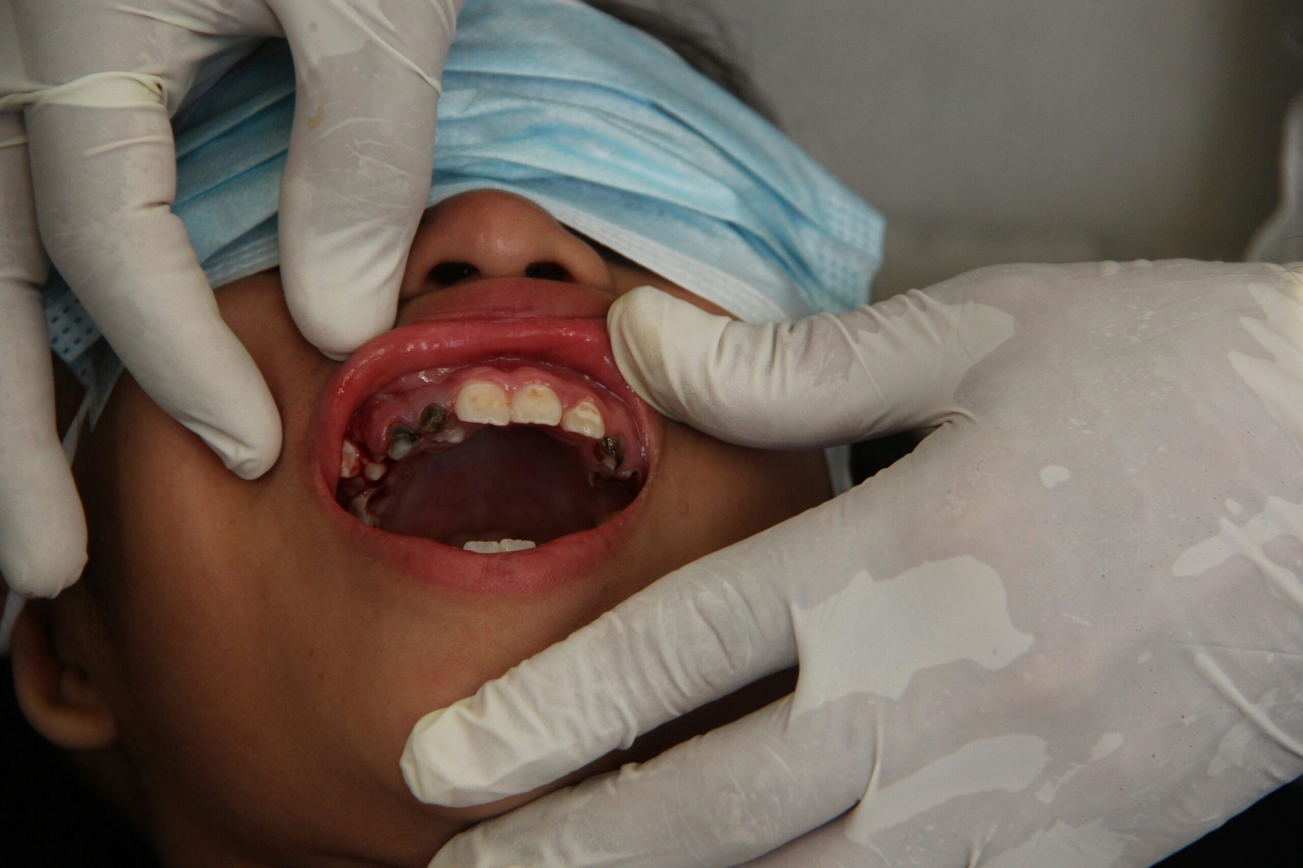 6 preventive care services every family should consider's lips to expose the upper teeth during a dental exam.
