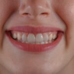 why preventive dentistry protects smiles from early decay