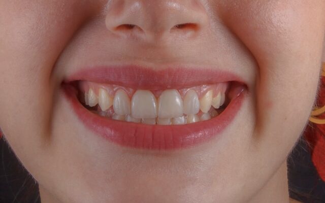 How Cosmetic Dentistry Shapes First Impressions