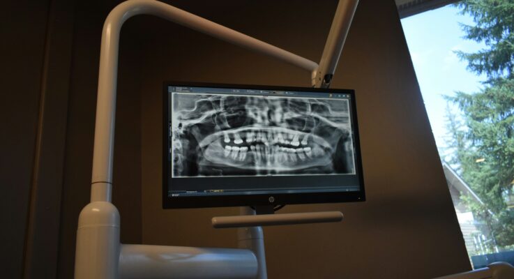 What To Expect At An Emergency Dental Visit: Exams, X Rays, And Relief