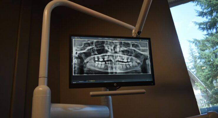 Monitor shows a panoramic dental X-ray of teeth mounted on a white articulating arm in a clinical room